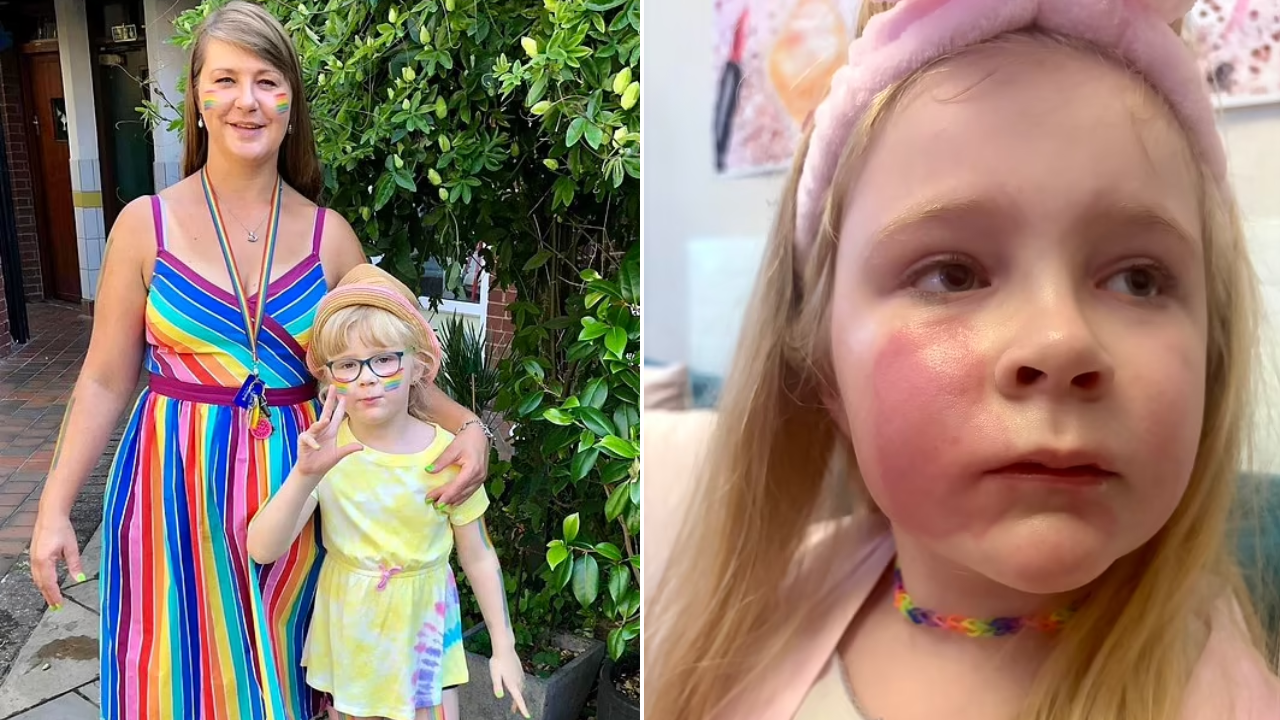 Warning over popular makeup item after eight year-old left with agonising burn from mum’s kiss